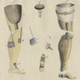 Illustration for article titled The History of Prosthetics Reveals a Long Tradition of Human Cyborgs